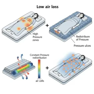 Visual representation of how a low air loss mattresses prevents pressure ulcers by constantly redistributing pressure points on the body.